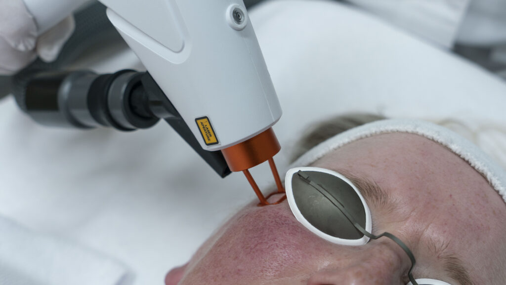 Prodeep fractional Frax