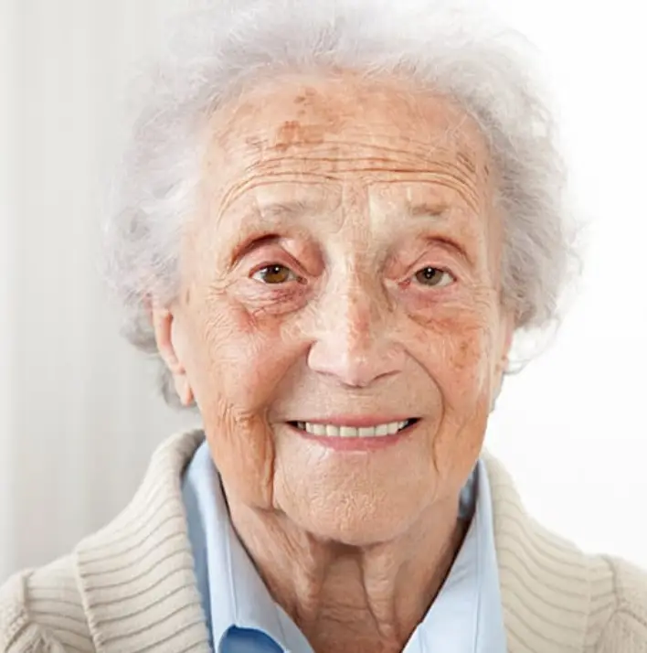Ouderdomsvlekken